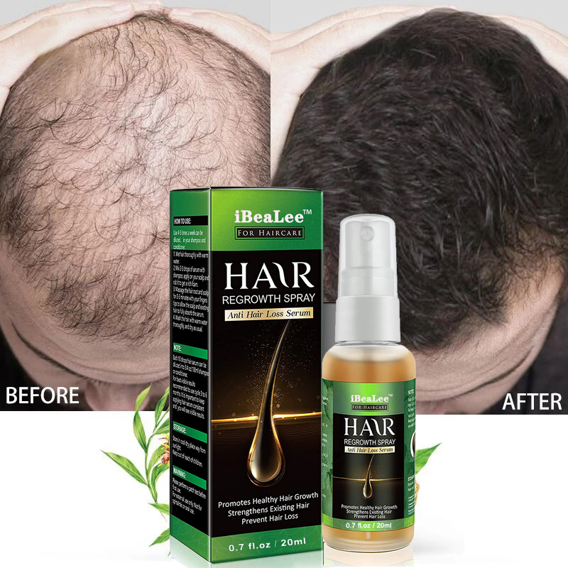 Ginger-Hair-Growth-Products-Fast-Growing-Hair-Essential-Oil-Beauty-Hair-Care-Prevent-Hair-Loss-Oil.jpg